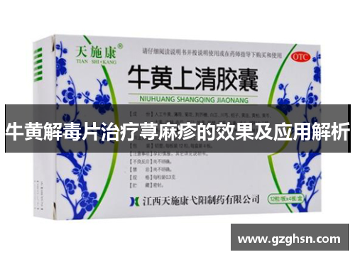 牛黄解毒片治疗荨麻疹的效果及应用解析